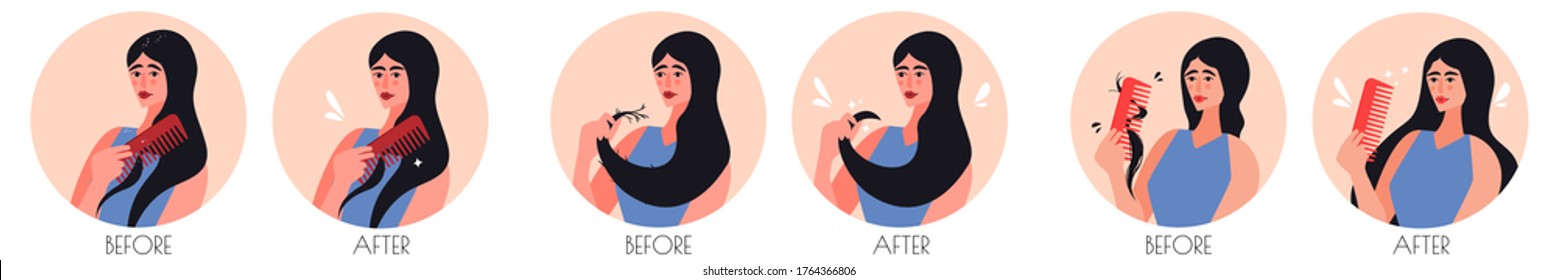 Before and after set of hair problems in flat cartoon style. Cut girl suffering from dandruff, split ends, hair loss. Rejuvenation