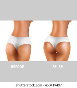 before and after sexy buttocks excercise