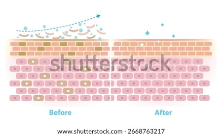 Before and after skin exfoliation vector illustration on white background. Cross section of remove dead skin cells on the surface and make skin smoother, softer and more youthful looking.