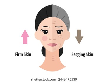 Before and after skin moisturization is seen in detail, with dried and cracked skin against a flawless smooth complexion. Vector flat illustration