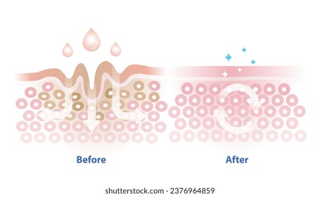 Ilustración vectorial de absorción del cuidado de la piel aislada sobre fondo blanco. Sección transversal de las arrugas cutáneas y tratamiento de la piel absorbida para ayudar a reducir el envejecimiento y el deterioro de la piel. Concepto de cuidado de la piel. 