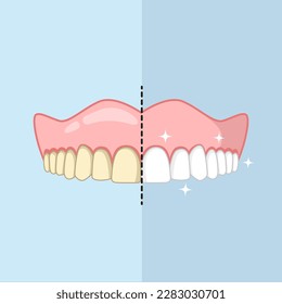 before and after teeth whitening isolated on sky blue background