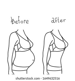 Antes y después del proceso de transformación. Procedimientos de belleza para mujeres embarazadas, Ilustración vectorial en el estilo doodle.