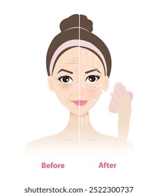 Antes y después de usar la herramienta de masaje Gua sha en la Ilustración vectorial de la cara de la mujer sobre fondo blanco. Reduzca las arrugas, la hinchazón, el círculo oscuro debajo de los ojos, levante, el contorno firme de la cara, mejore la circulación de la piel.