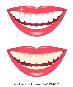 before and after whitening teeth isolated on white background/whitening teeth