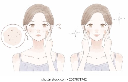 Before and after of women suffering from darkening pores. On white background. svg