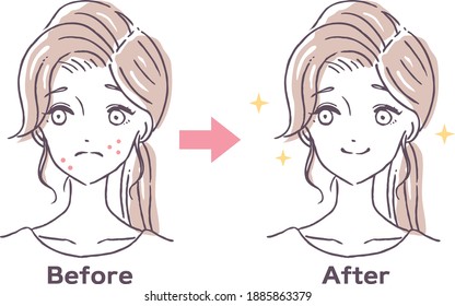 before and after of women suffering from rough skin