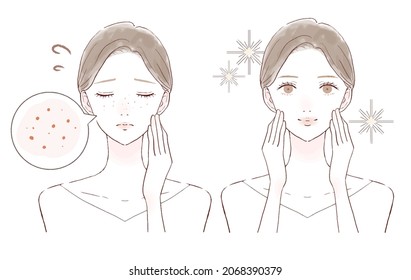 Before and after of women suffering from sebum pores. On white background.