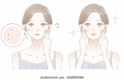 Before and after of women suffering from sebum pores. On white background.