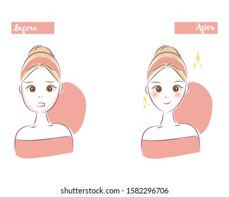 Before and after women undergoing plastic surgery. Beauty surgery for v-shaped cheeks. Beauty cartoon character illustration.