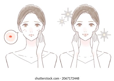 Before and after of women who care about acne. On white background.