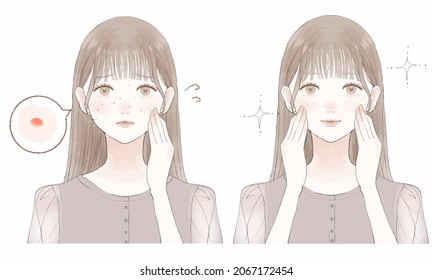Before and after of women who care about acne. On white background.