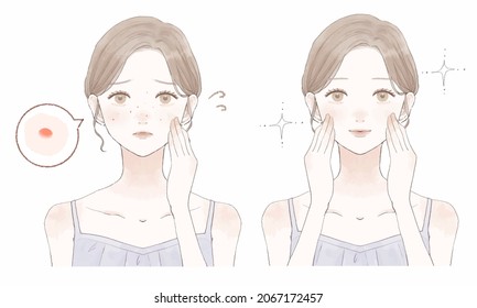 Before and after of women who care about acne. On white background.