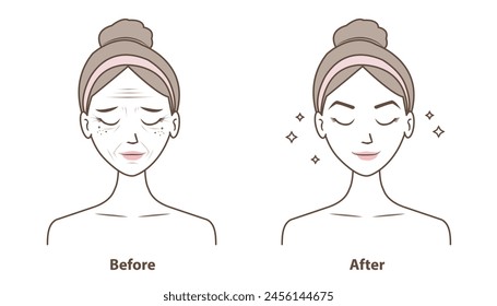 Before and after wrinkles on woman face vector illustration isolated on white background. Comparison of aging, damaged and beauty skin in cartoon style. Skin care and beauty concept.