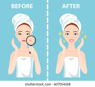 Before-After set of upset troubled and happy woman with female facial skin problems needs to care about: acne, pimples.