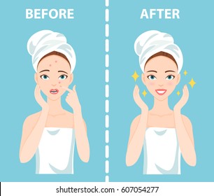 Before-After set of upset troubled and happy woman with female facial skin problems needs to care about: acne, pimples.