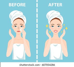 Before-After set of upset troubled and happy woman with female facial skin problems needs to care about: blackheads, clogged nose pores.