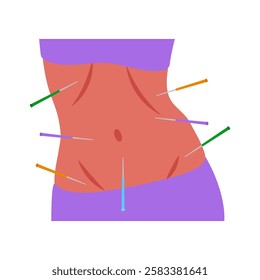 Belly Acupuncture flat vector illustration isolated