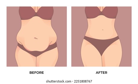 Belly fat. Before and after weight loss, woman body shape transformation, Fat To Fit. 