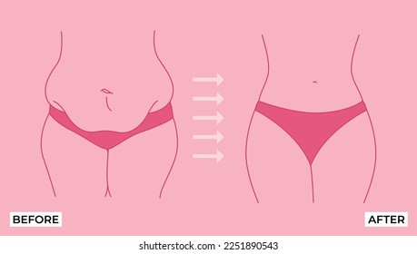 Belly fat. Before and after weight loss, woman body shape transformation, Fat To Fit. 
