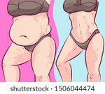 Belly fat, before-after. Vector illustration