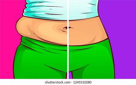 Belly fat, before-after. Vector illustration