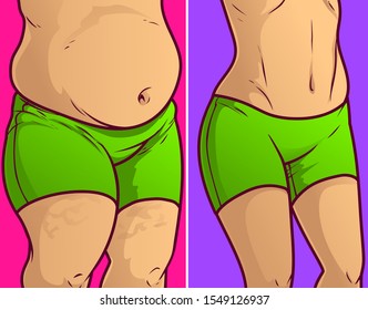 Belly fat, before-after. Vector illustration