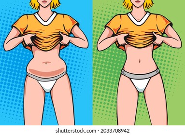 Belly fat woman before and after. Weight loss in waist side by side concept illustration in pop art comics style