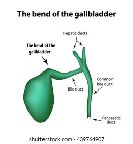 The bend of the gallbladder. Pathology of the gallbladder. Cholecystitis. The structure of the gallbladder. Infographics. Vector illustration on isolated background.