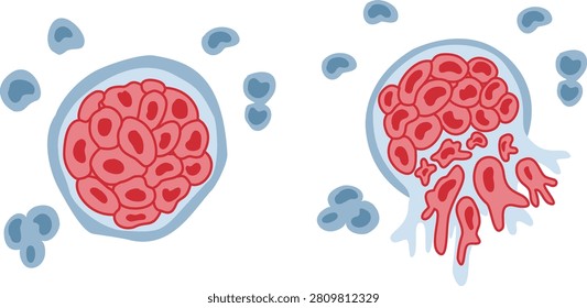 Benign and malignant tumor cell growth comparison vector illustration with diagram showing cancer progression and metastasis stages