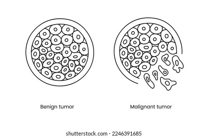 Benign and malignant tumor line icon in vector, illustration of oncology.