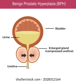 18,641 Bladder Icon Images, Stock Photos & Vectors | Shutterstock