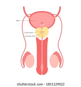 Benign prostatic hyperplasia logo for clinic. Male reproductive system concept. Prostate gland, bladder, testicle anatomy. Human Internal organs vector illustration. Medical exam, laboratory research.