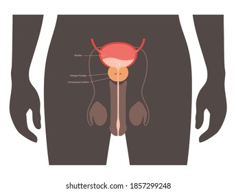 Benign prostatic hyperplasia logo for clinic. Male reproductive system concept. Prostate gland, bladder and testicle anatomy in human silhouette. Internal organs in man body flat vector illustration.