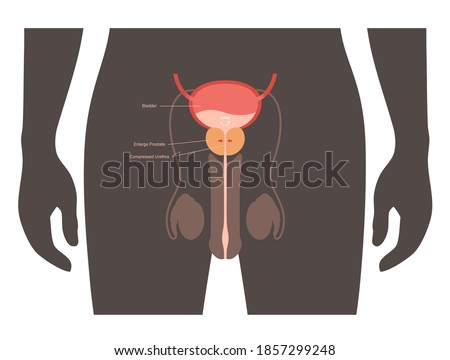 Benign prostatic hyperplasia logo for clinic. Male reproductive system concept. Prostate gland, bladder and testicle anatomy in human silhouette. Internal organs in man body flat vector illustration.