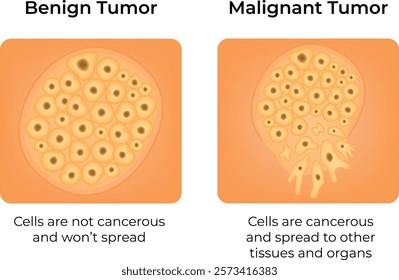 Benign Tumor Malignant Tumor Science Design Vector Illustration DIagram