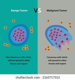 Benign Tumor vs Malignant Tumor cell, cancer cells