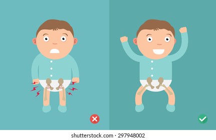 Best and worst positions child for prevention of hip dysplasia,illustration, vector