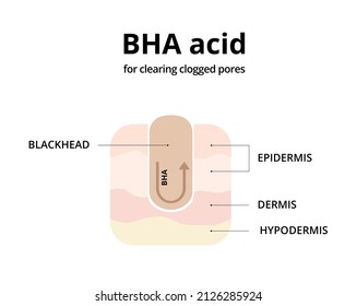 BHA Acid For Cleaning Clogged Pores. Removing Blackheads, Salicylic Acid, Oily Skin. For Topics Like Cosmetology, Treatment, Exfoliating