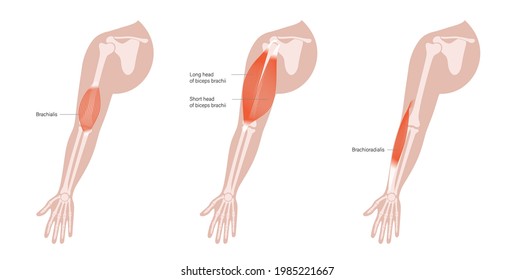 Brachialis Muscle Images Stock Photos Vectors Shutterstock