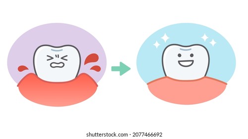 Bifore of gingivitis Bifore Cute Illustrations