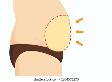 Big belly of fat people and focus on bulging stomach with Dotted line. Illustration about weight and health problem.