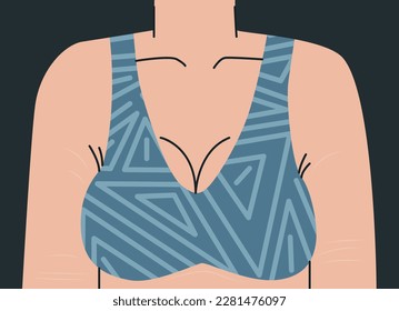 Big female bust in bra. Woman's body with stretch marks on her arms and chest. Upper female body in geometric print top. Vector trend illustration for design.