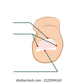 Big toe with nail. Flat vector illustration isolated on white background. Design of instructions, means, drugs for the treatment of fungus. Take care of the beauty of the body.