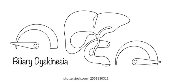 Biliary Dyskinesia. A condition of increased or too deteriorated functioning of the biliary tract. Single line diagram of the disease. Isolated vector. 