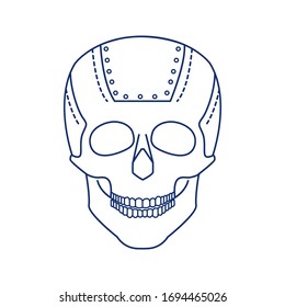 Bio artificial plate on the skull black line icon. Special material in the human skull, established in connection with damage to the skull. Pictogram for web page, mobile app, promo. Editable stroke.