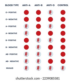 Biochemistry lab test illustration, enzyme immunoassay and blood test vector