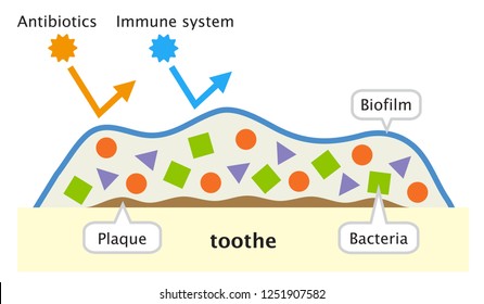 Biofilm On Tooth Illustration. Dental And Oral Care Concept