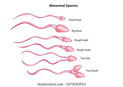 Biological Anatomy of Abnormal Sperms (Abnormal sperm classification)