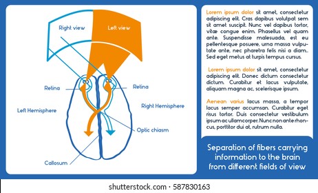 Biological Asymmetry. Vector Scheme. Separation Of Fibers Carrying Information To The Brain From Different Fields Of View.